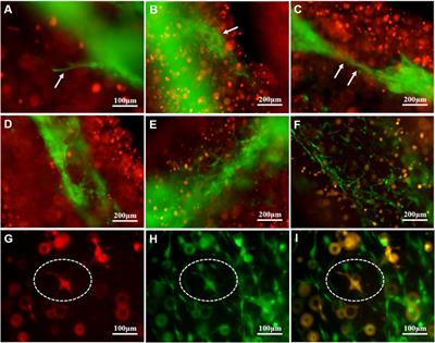 Coaxially Bioprinted Cell-Laden Tubular-Like Structure for Studying Glioma Angiogenesis